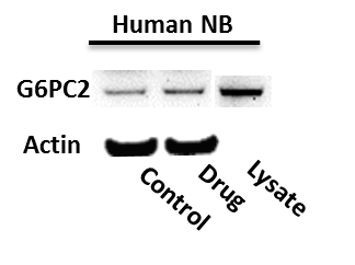 G6PC2 Overexpression Lysate NBL1-10897