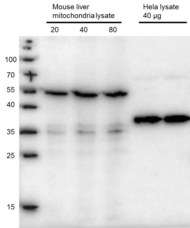 GHITM Antibody NBP1-47217