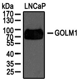 GOLM1 Antibody NBP1-50627