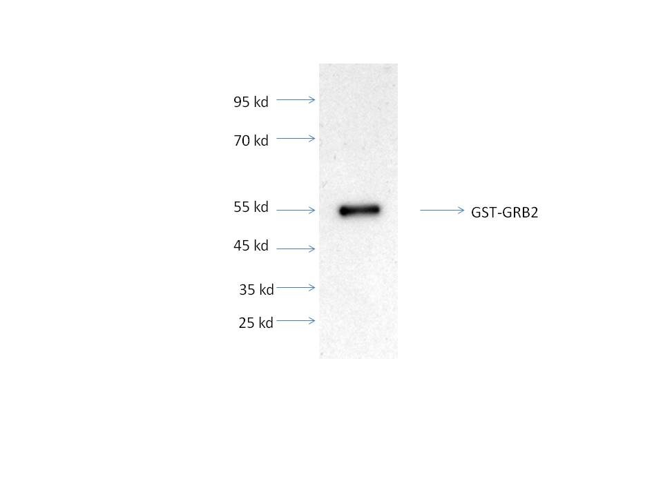 Recombinant Human GRB2 GST (N-Term) Protein H00002885-P01