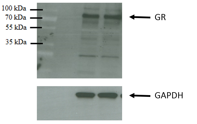 GR/NR3C1 Antibody (BuGR2) - BSA Free NB300-731