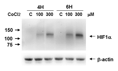 HIF-1 alpha Antibody (H1alpha67) NB100-105