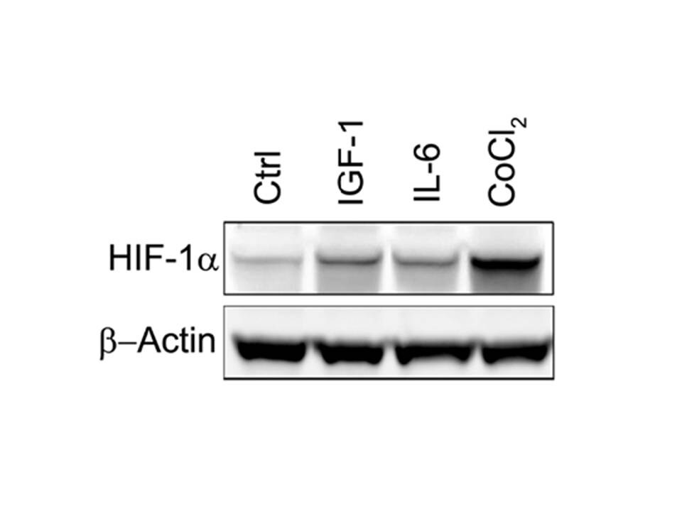 HIF-1 alpha Antibody NB100-449
