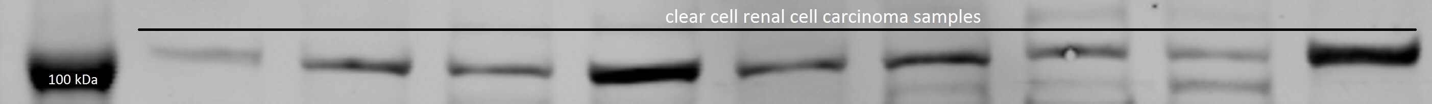 HIF-2 alpha/EPAS1 Antibody - BSA Free NB100-122