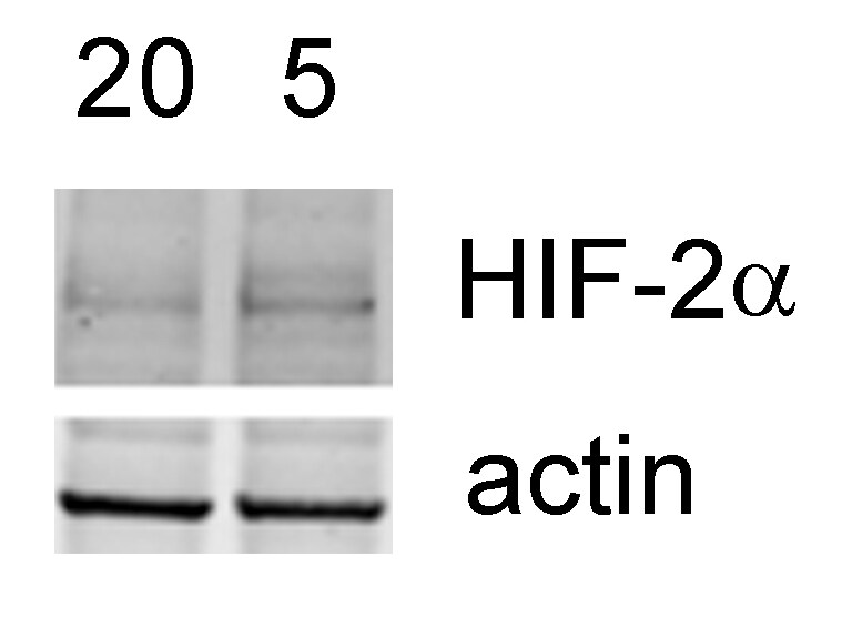 HIF-2 alpha/EPAS1 Antibody (ep190b) NB100-132