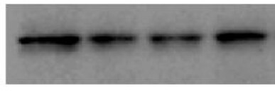 HIF-2 alpha/EPAS1 Antibody (ep190b) NB100-132