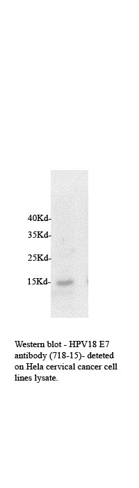 HPV18 E7 Antibody (718-15) - BSA Free NB110-17215