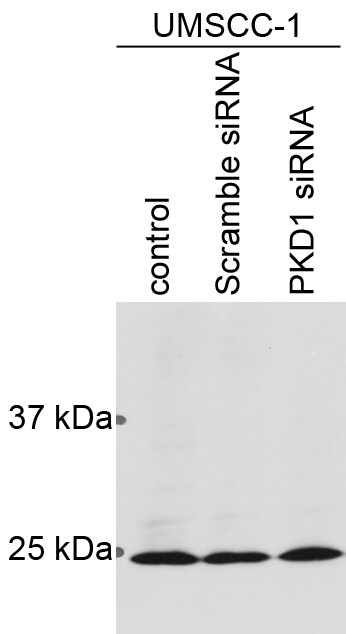 HSP27 Antibody NB120-5579