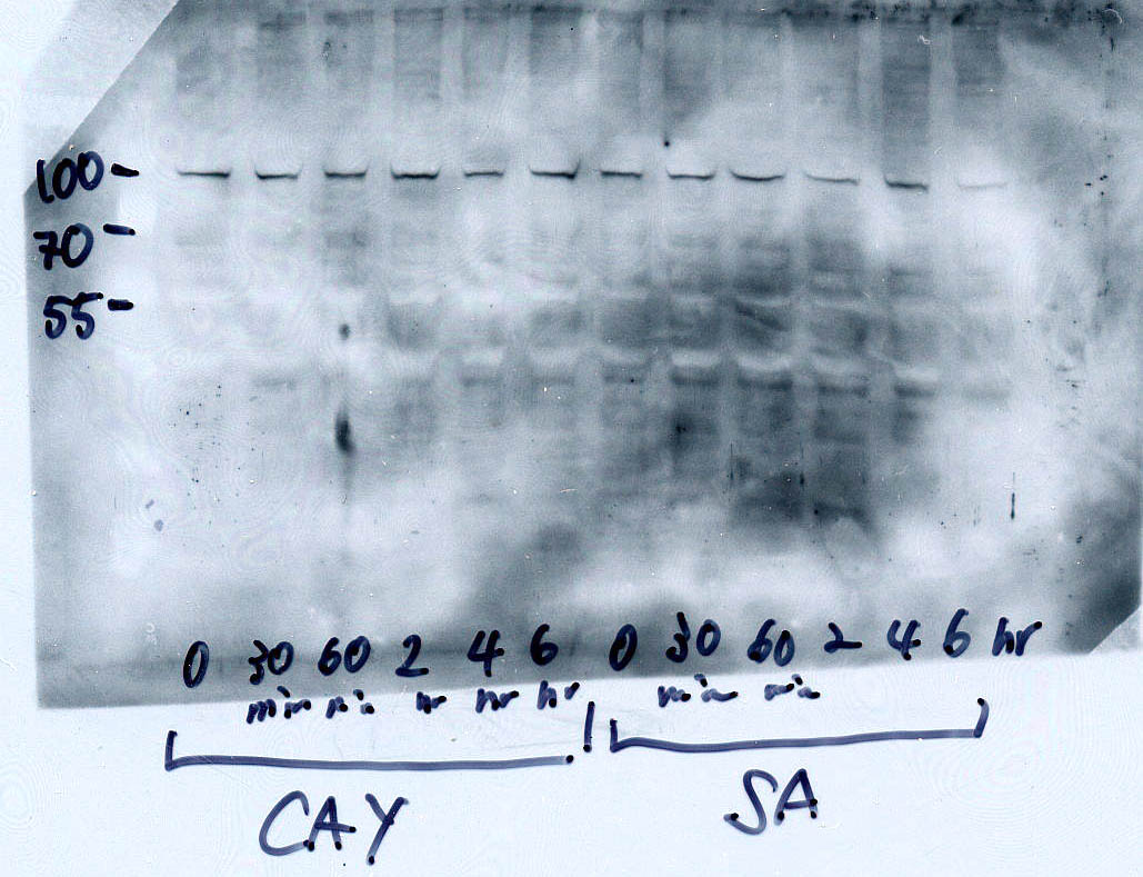 IKK beta Antibody (10AG2) - BSA Free NB100-56509