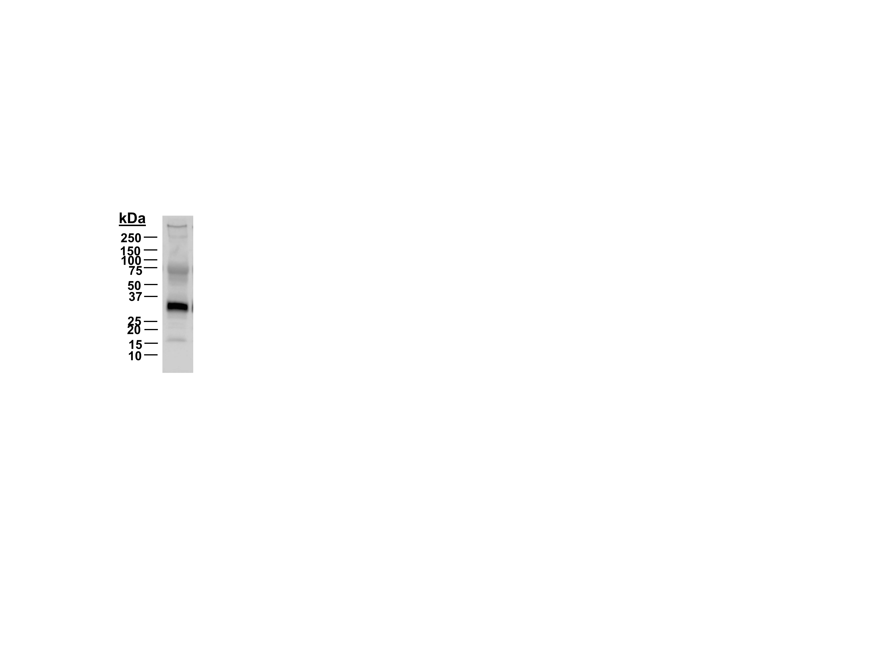 IL-1 beta/IL-1F2 Antibody - Azide and BSA Free NB600-633