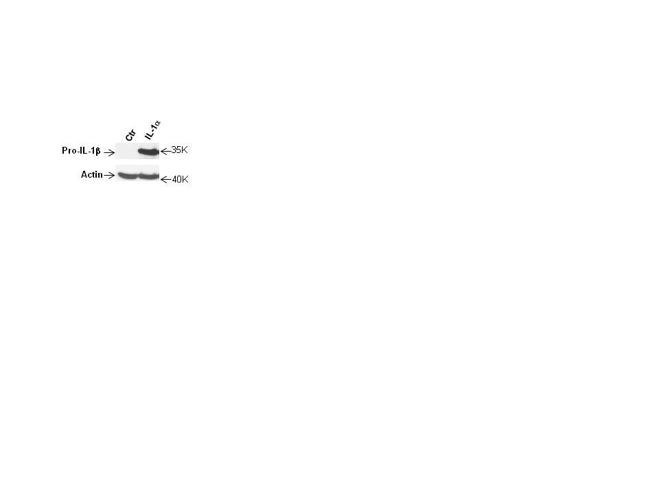 IL-1 beta/IL-1F2 Antibody - Azide and BSA Free NB600-633