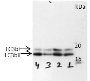 LC3B Antibody [Biotin] NB100-2220B