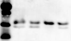 LC3A Antibody - BSA Free NB100-2331