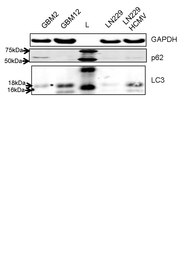 LC3A Antibody - BSA Free NB100-2331