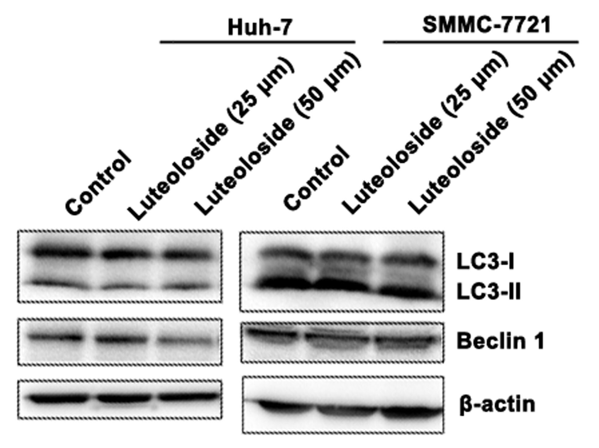 LC3B Antibody - BSA Free NB100-2220
