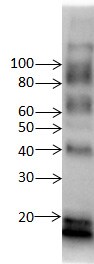 LC3B Antibody - BSA Free NB600-1384
