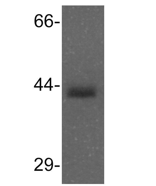 MAT2B Antibody - BSA Free NBP1-56616