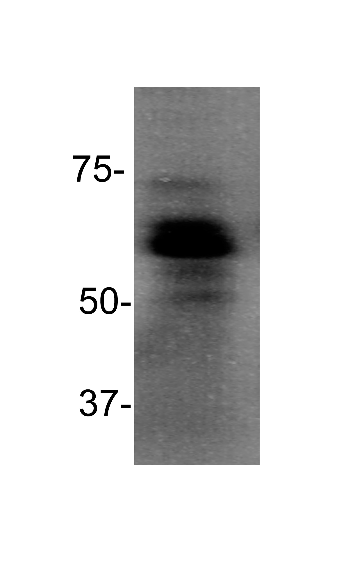 MBD1 Antibody (100B272.1) - BSA Free NB100-56537