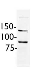 MED17 Antibody (1B5) - Azide and BSA Free H00009440-M02