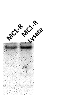 Melanocortin-1 R/MC1R Overexpression Lysate NBL1-12937