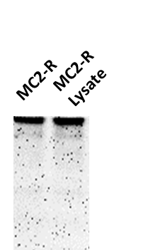 Melanocortin-2 R/MC2R Overexpression Lysate NBP2-04160