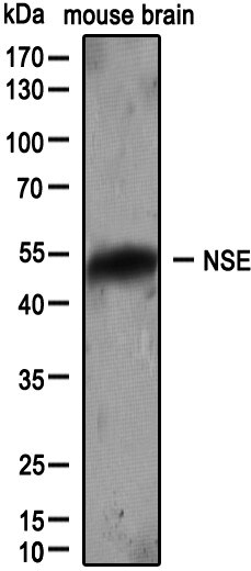 Enolase 2/Neuron-specific Enolase Antibody NB110-58870