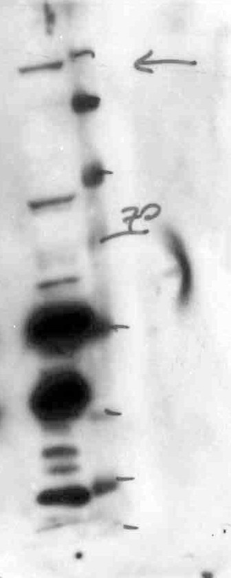 Nephrin Antibody (Y17-R) NBP1-30130