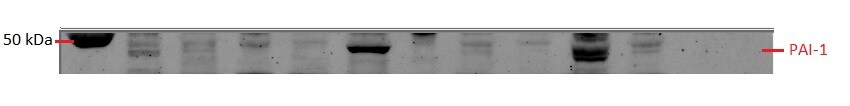 Serpin E1/PAI-1 Antibody - BSA Free NBP1-19773
