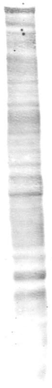 PEAK1 Antibody - BSA Free NBP1-91052
