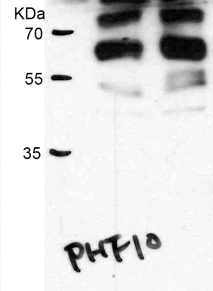 PHF10 Antibody - BSA Free NBP2-19795