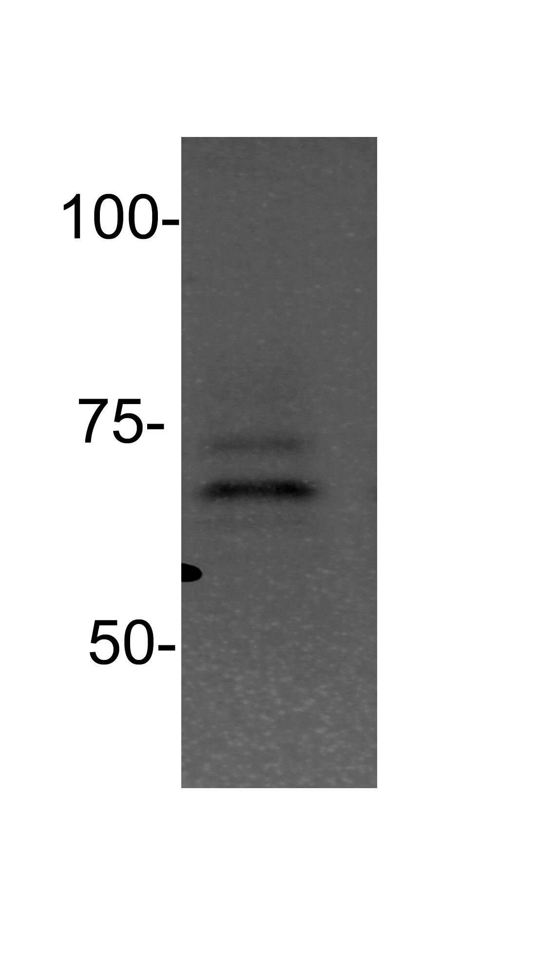 PIAS2 Antibody NBP1-52022