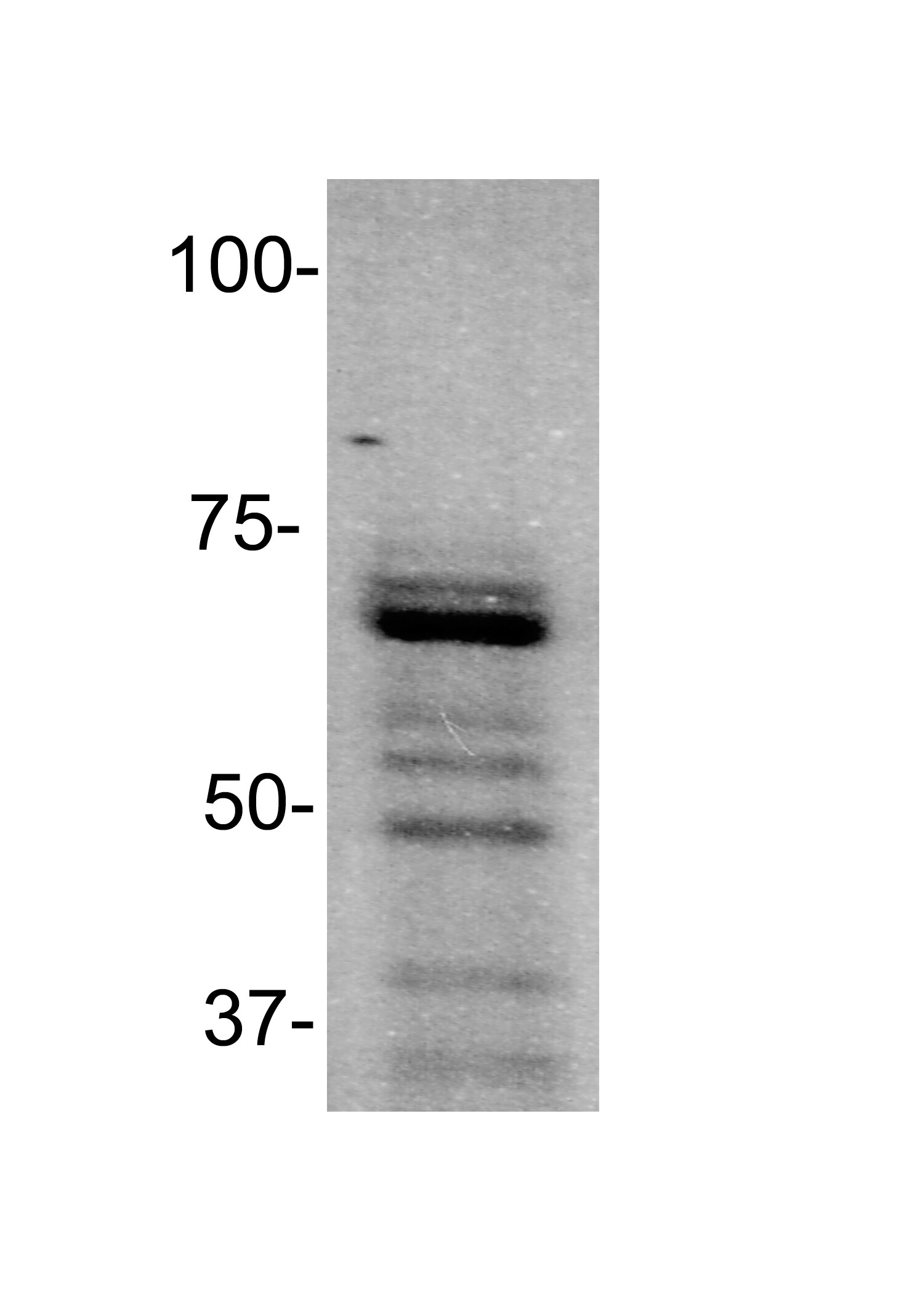 PIAS3 Antibody - BSA Free NBP1-77160