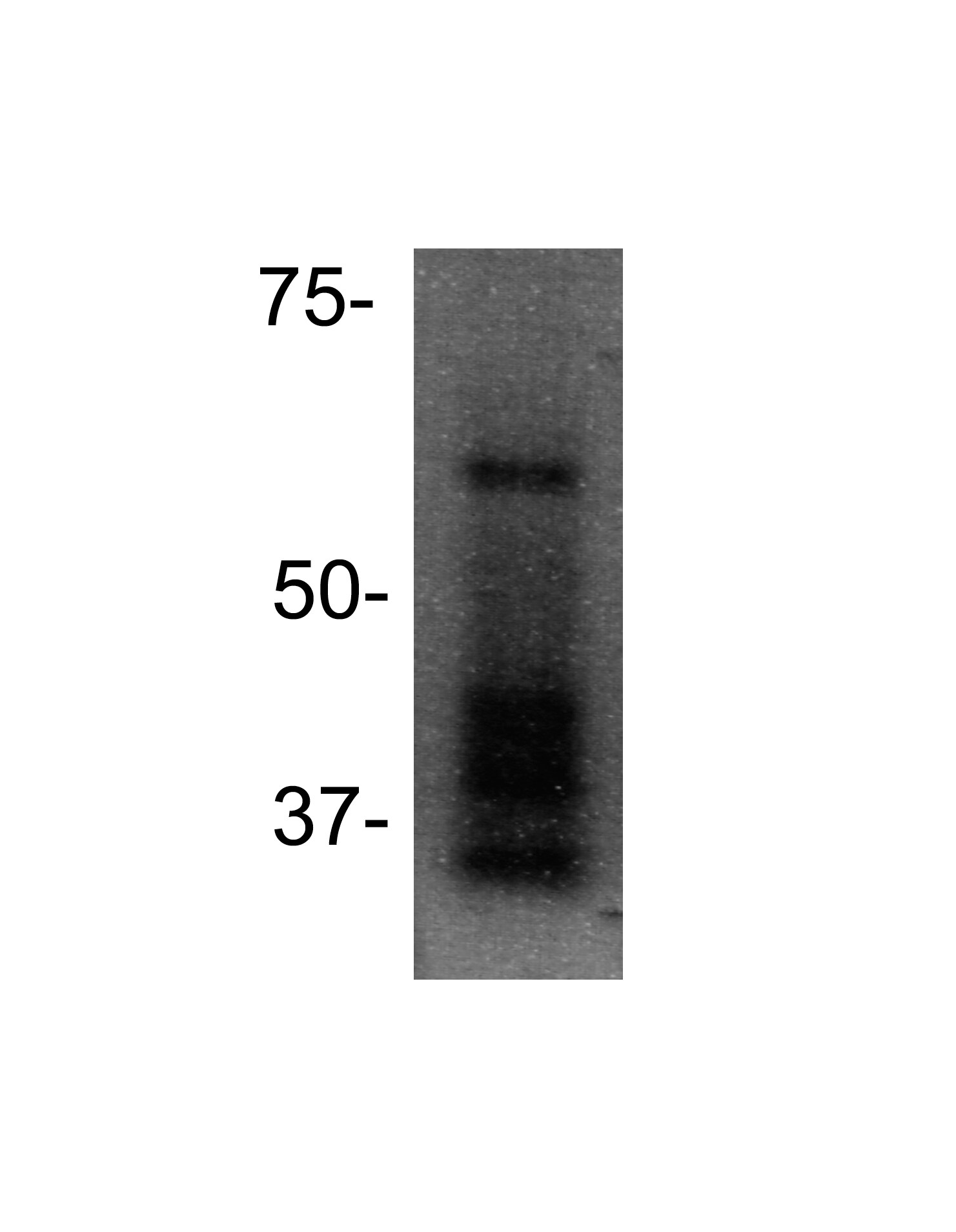 PIASy Antibody NB600-1318