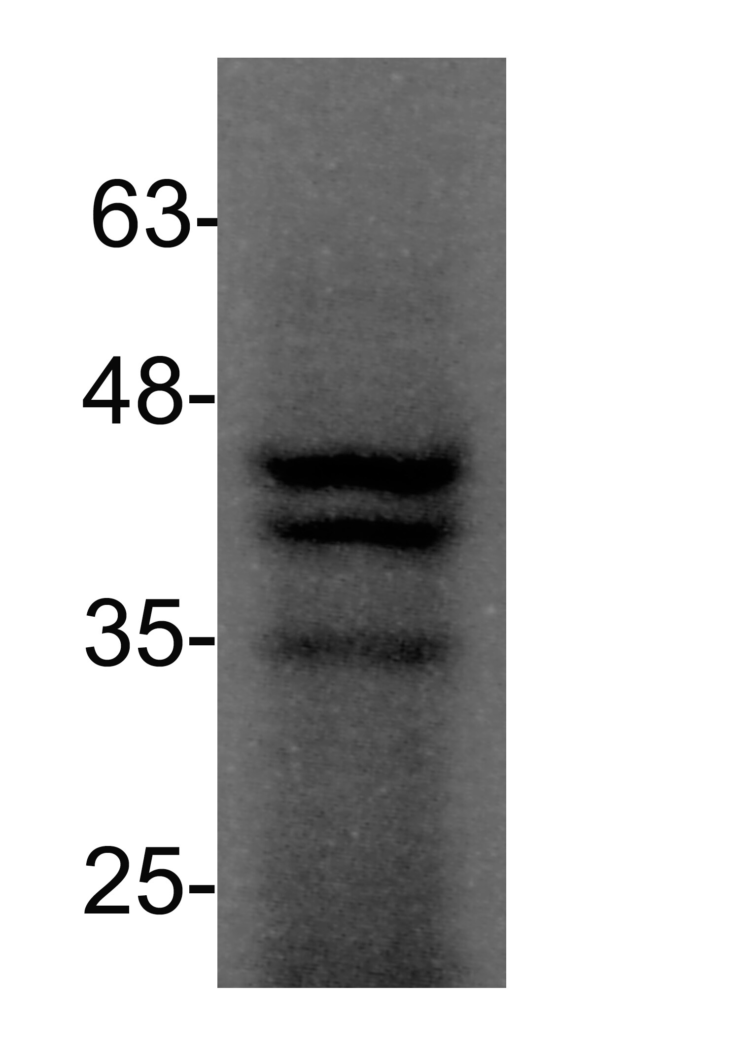 PU.1/Spi-1 Antibody NBP1-00135