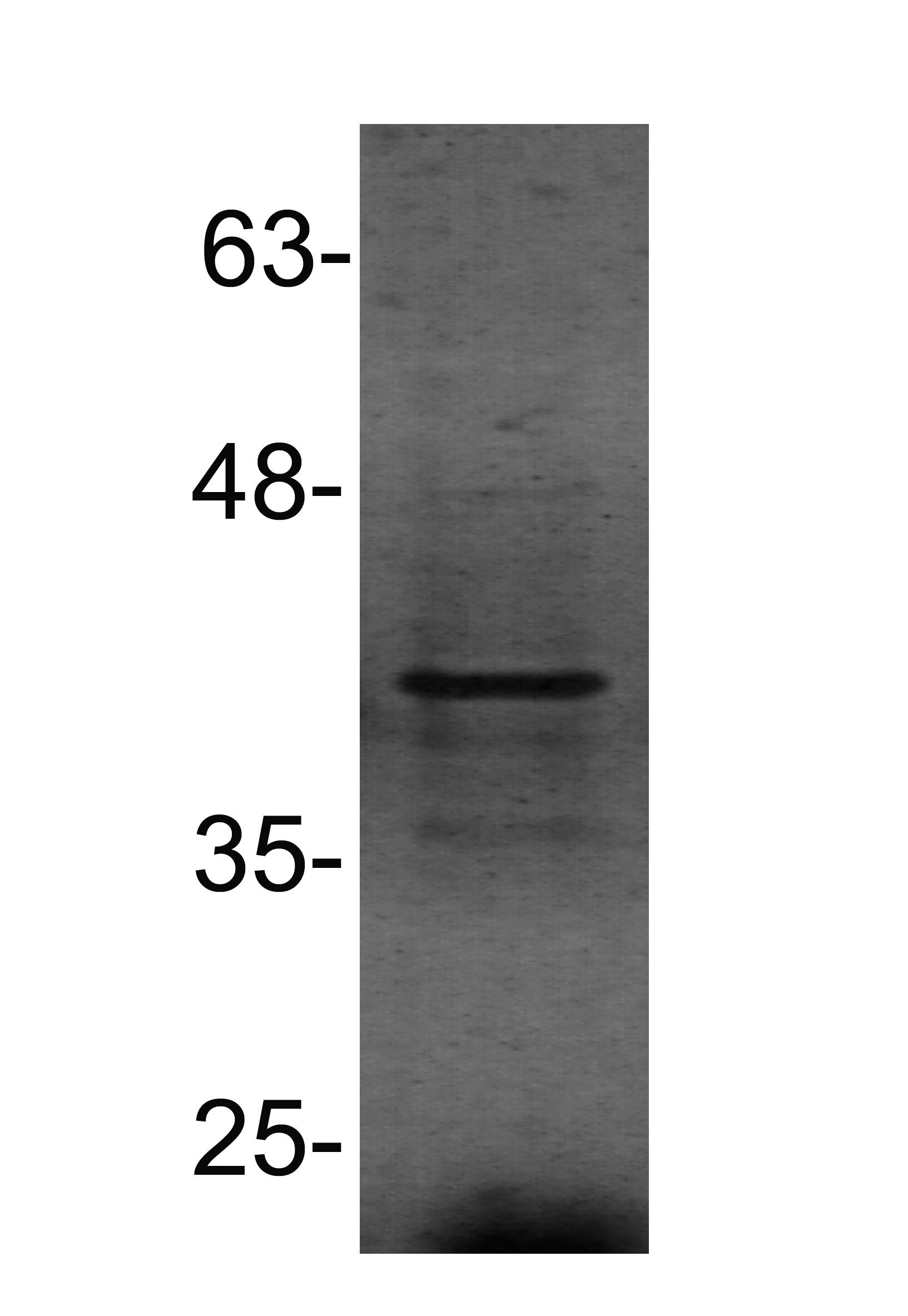 PU.1/Spi-1 Antibody NBP2-27163