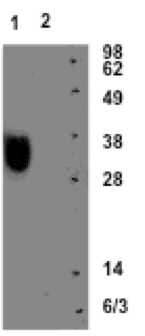 Phosphoserine phosphatase Antibody - BSA Free NBP1-56848