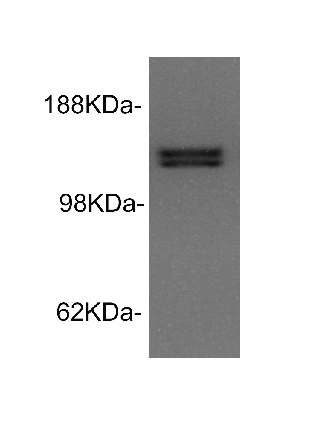 RIP140 Antibody - BSA Free NBP2-13674
