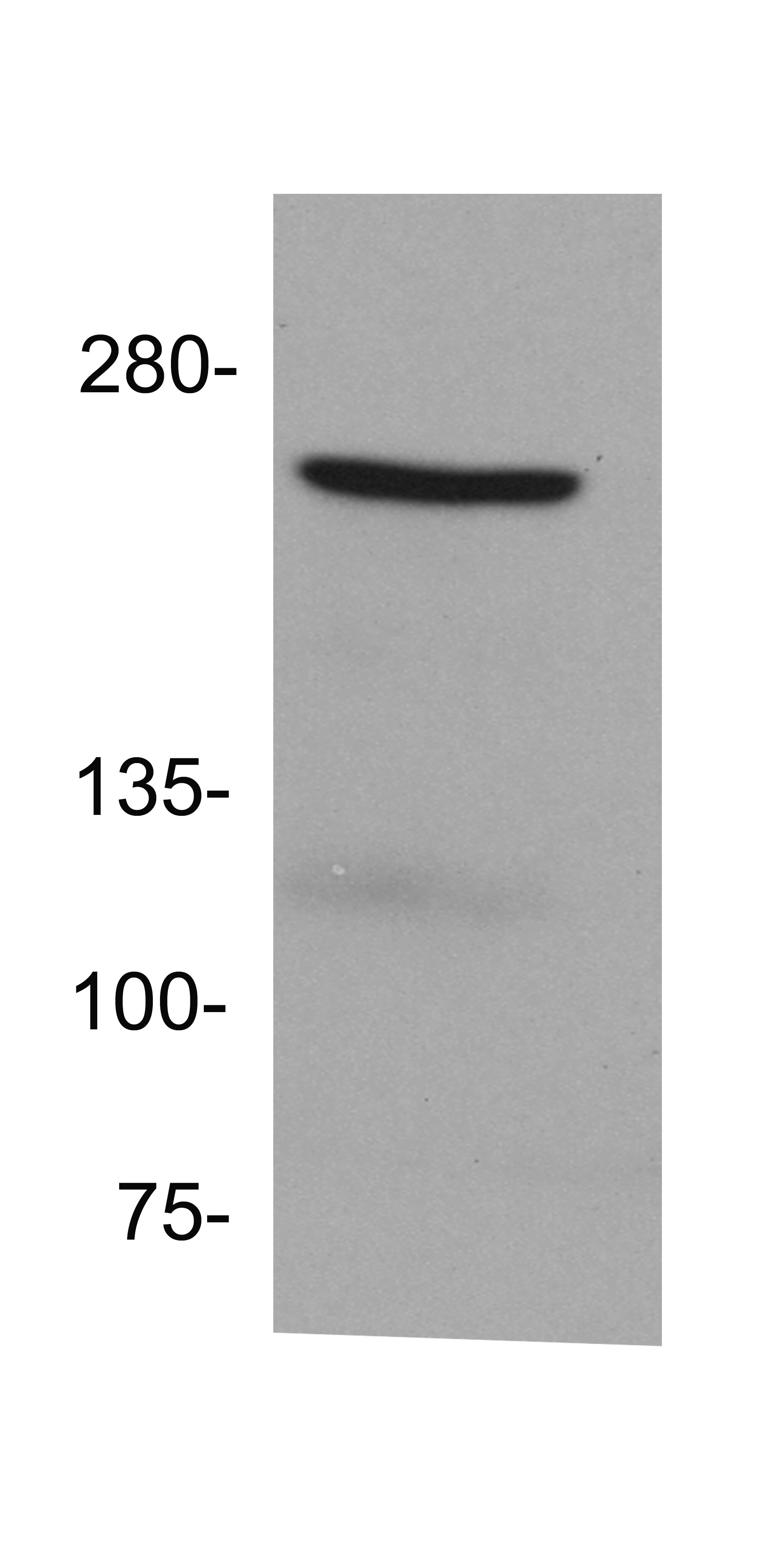 RNA Polymerase II/POLR2A [p Ser2] Antibody NB100-1805