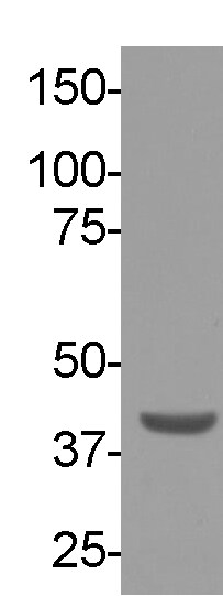 RNASEH2B Antibody (673) - Azide and BSA Free NBP2-43776