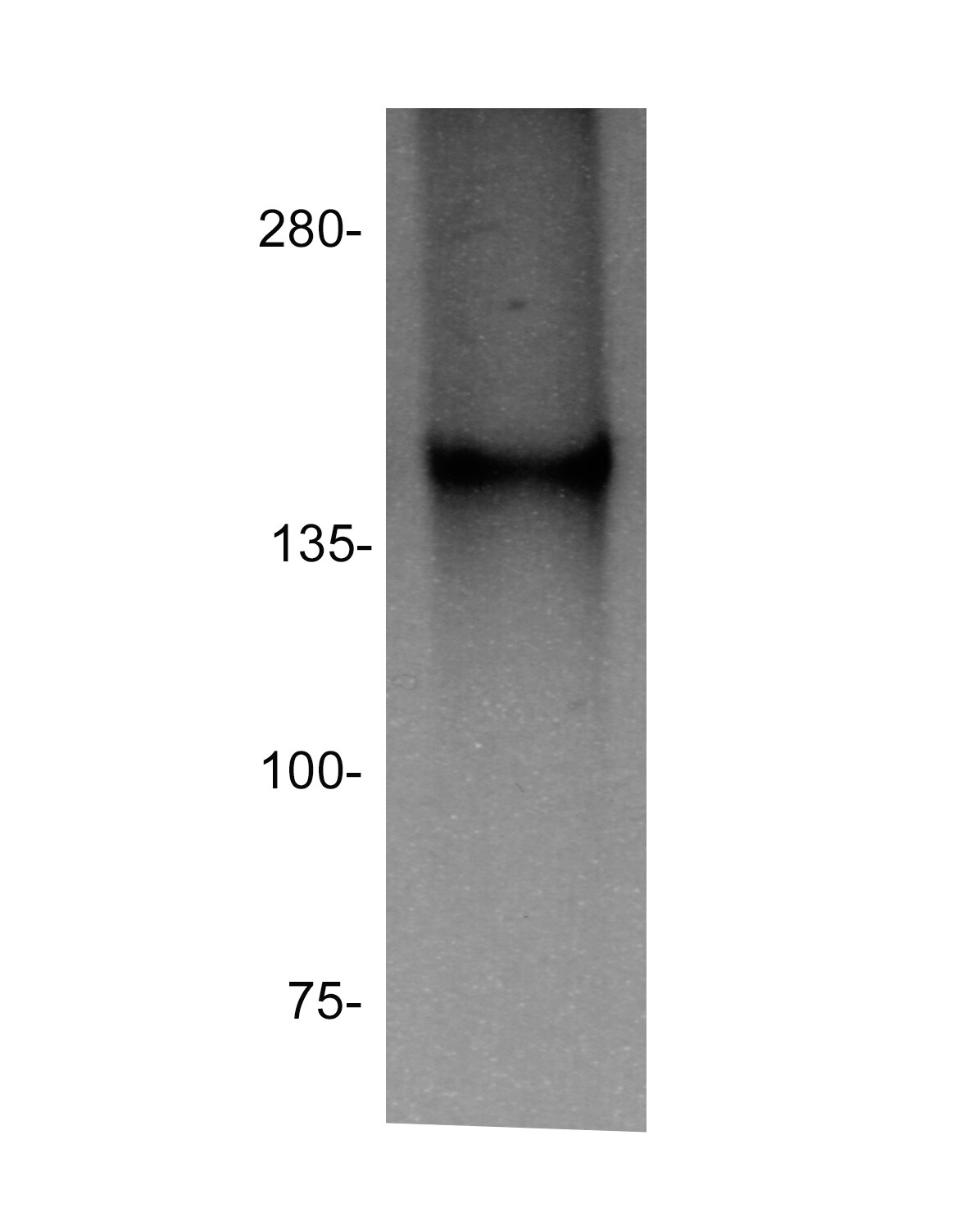 Rad50 Antibody - BSA Free NB100-154