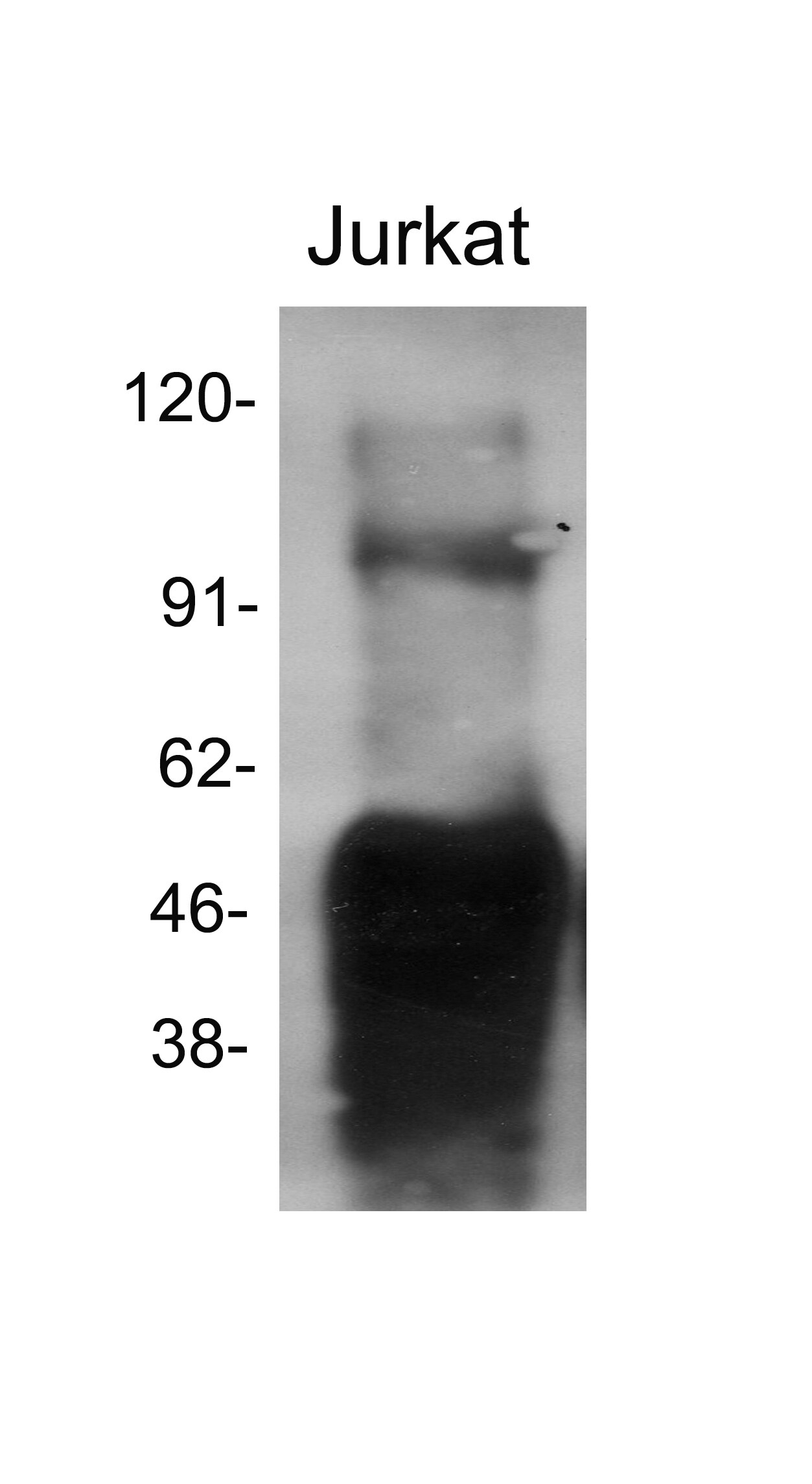 RB1 Antibody - BSA Free NB100-56888