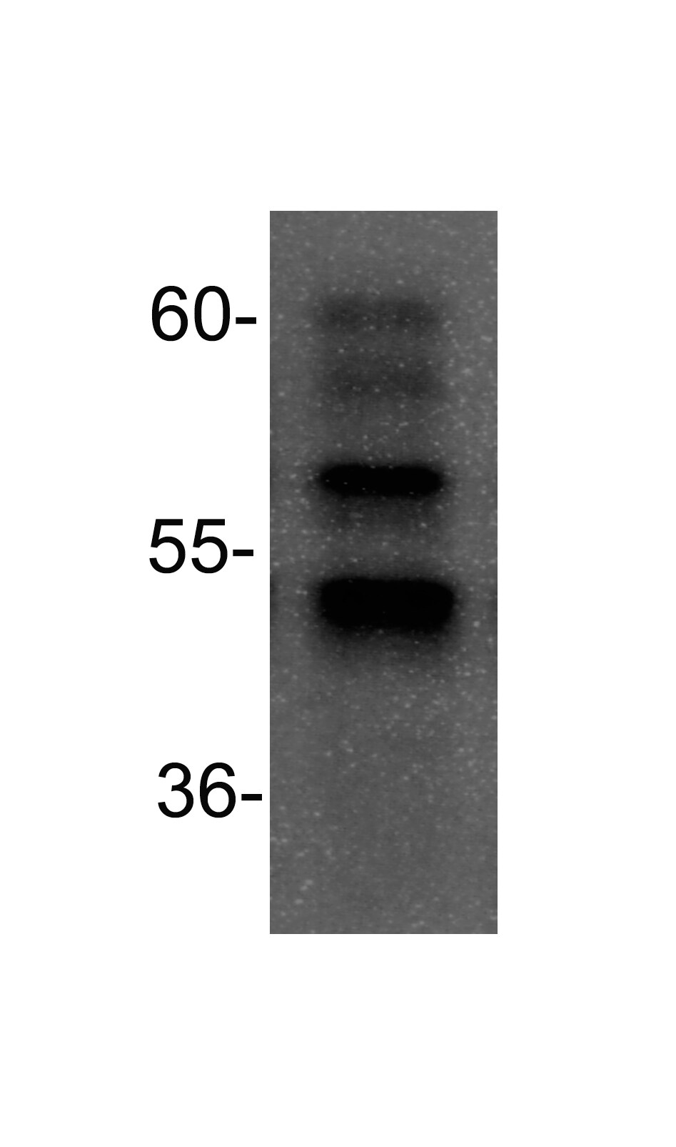 RAR alpha/NR1B1 Antibody (763) - Azide Free NB200-322