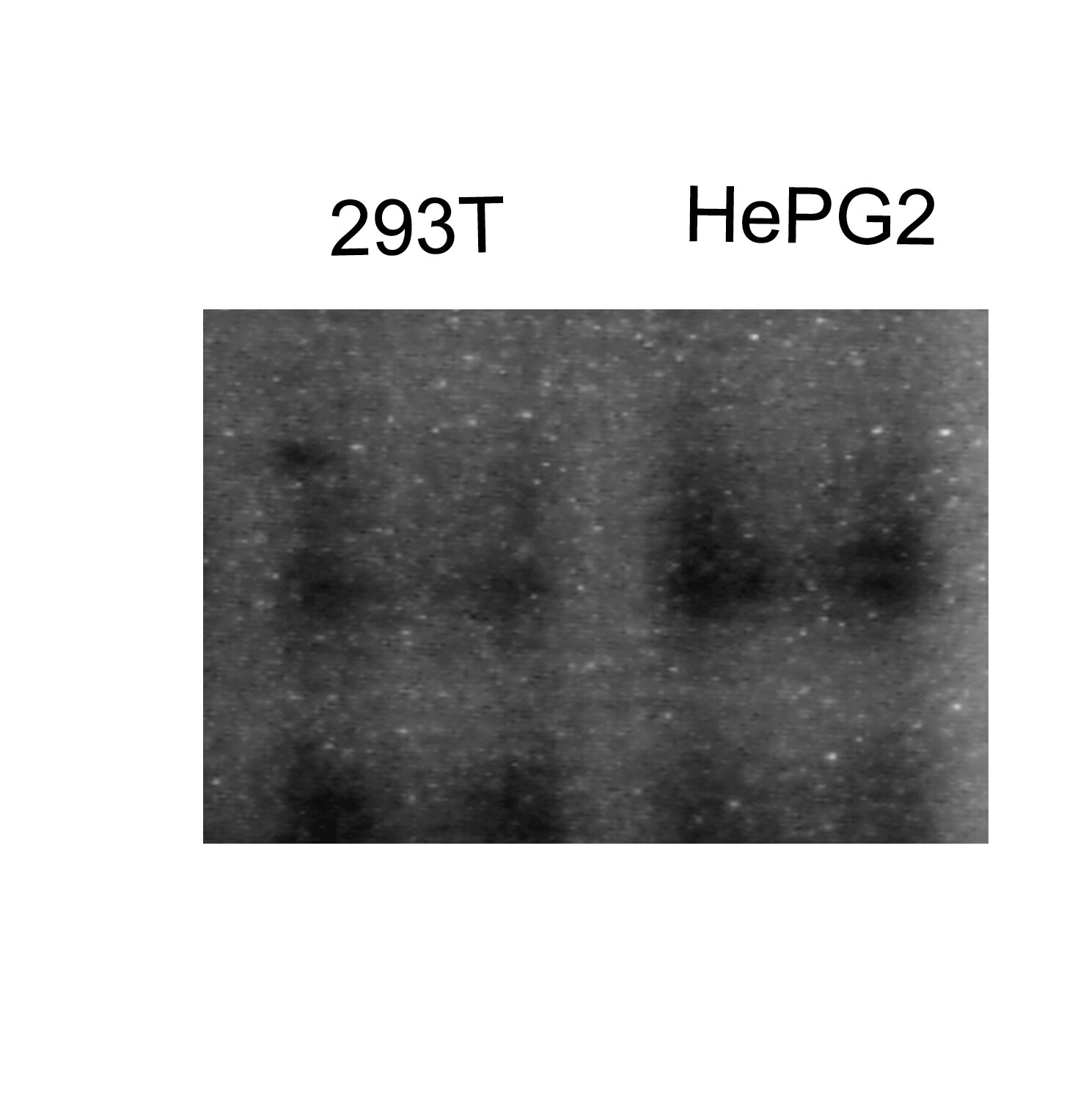 RAR beta/NR1B2 Antibody (336) - Azide Free NB200-323