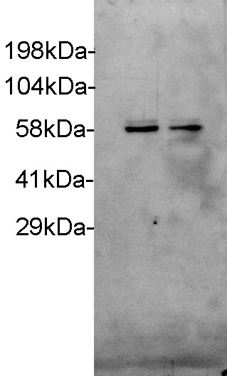 p70 S6 Kinase/S6K Antibody (4H4) - Azide and BSA Free H00006198-M04