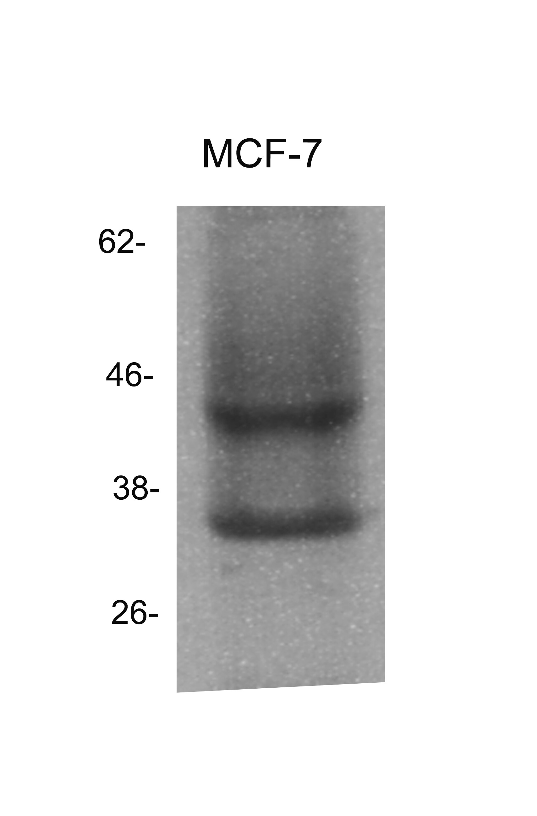 SET Antibody - BSA Free NBP1-30888
