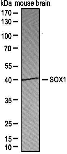 SOX1 Antibody NBP2-24486