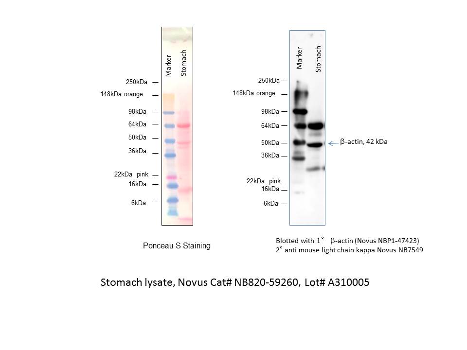 Human Stomach Whole Tissue Lysate (Adult Whole Normal) NB820-59260