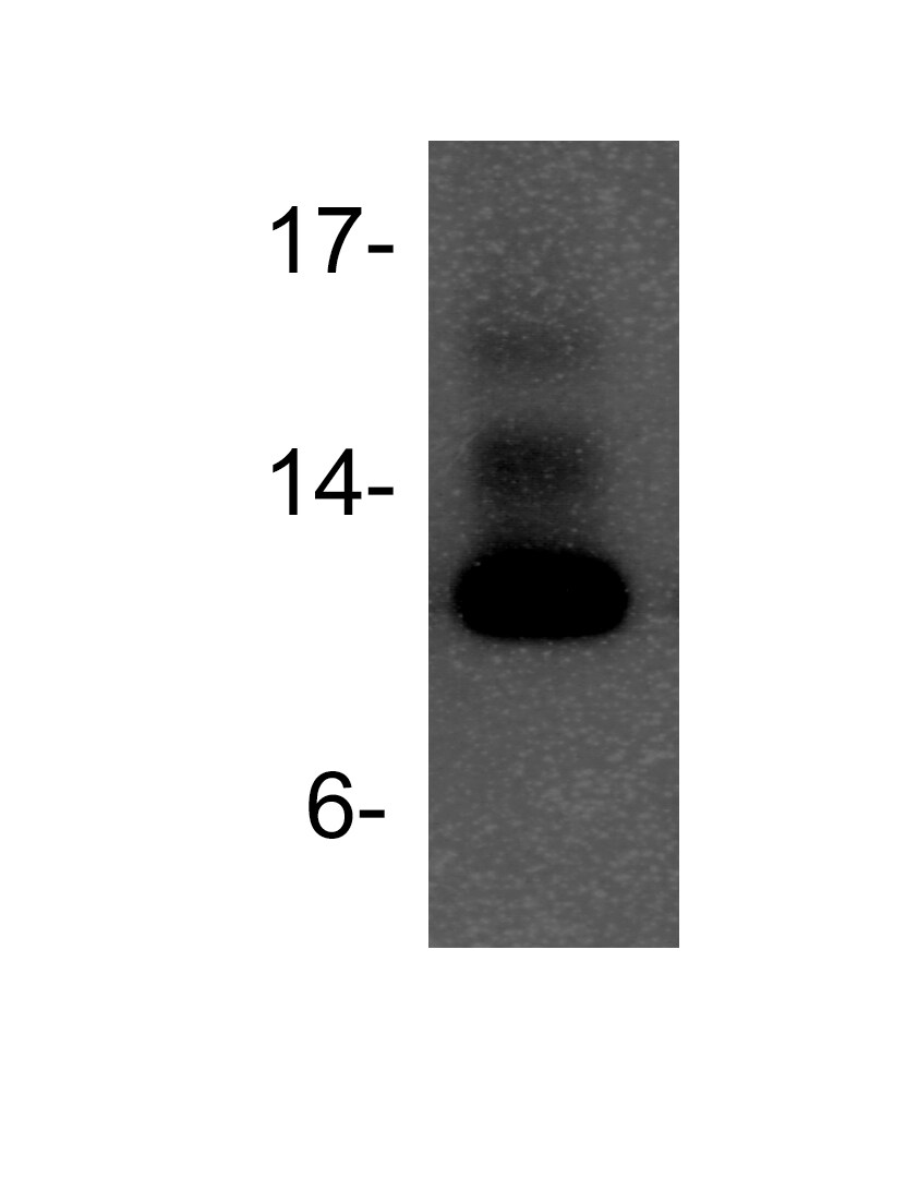 TFF1/pS2 Antibody (GE2 (same as R47/94)) NBP2-34293