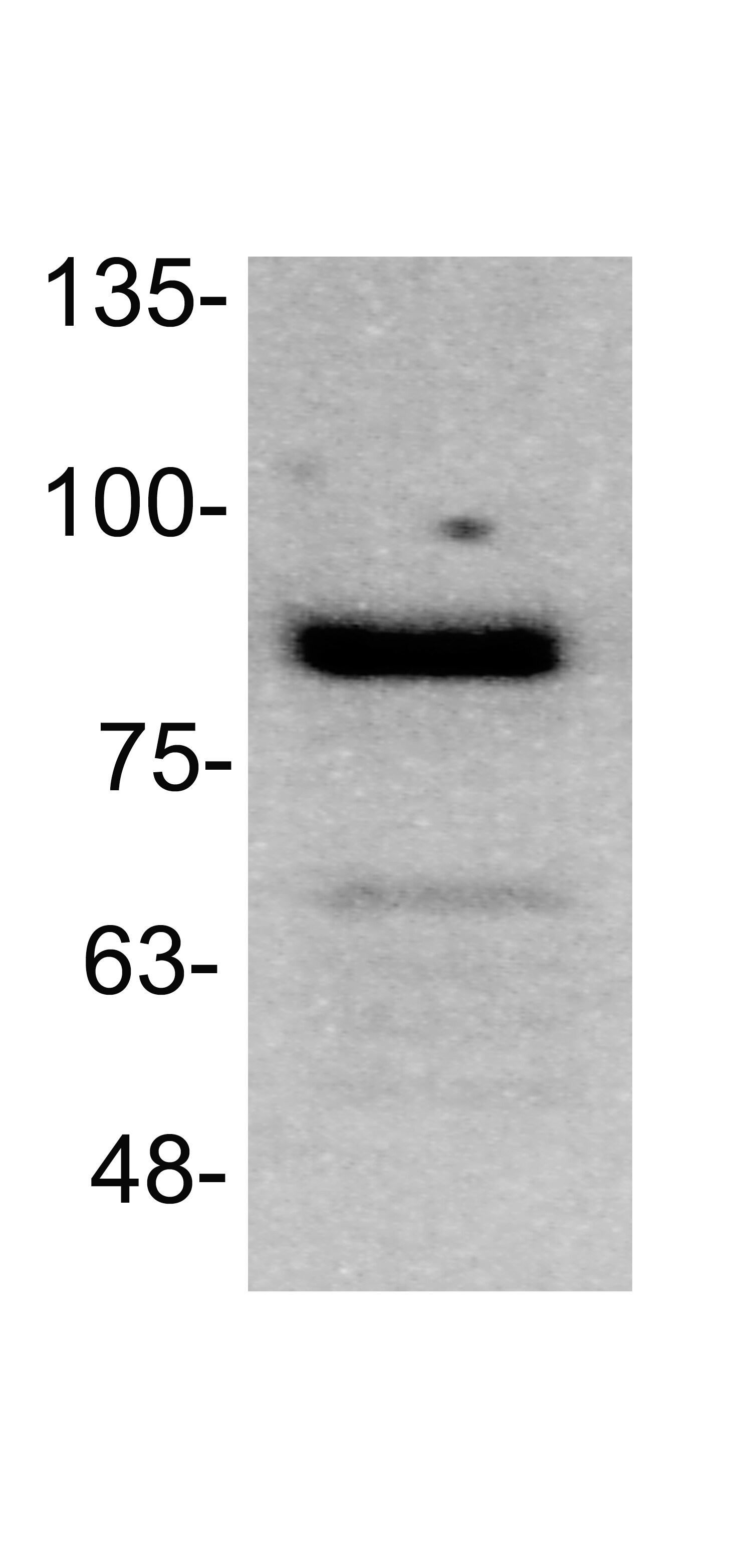 TGN46 Antibody - BSA Free NBP1-86949