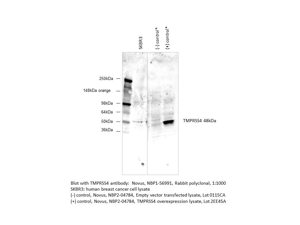 TMPRSS4 Antibody - BSA Free NBP1-56991